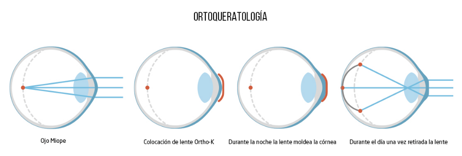 ortho-3